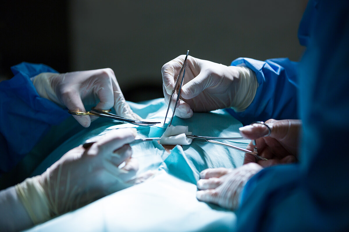 Chirurdzy przy stole operacyjnym - Rodzaje chirurgii i chirurgów