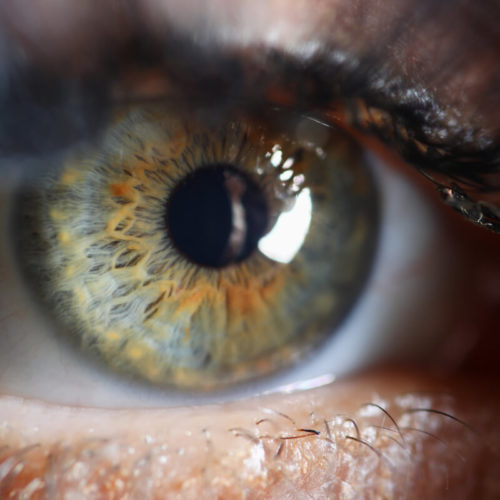 Oko - zbliżenie. Badanie OCT oka - gdzie w Polsce można je wykonać