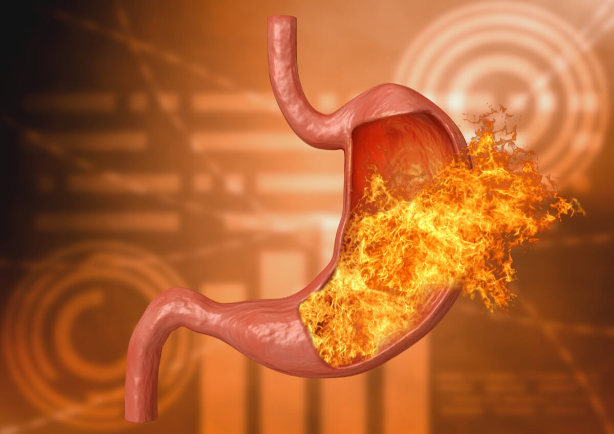 Żołądek pełen płomieni. 5 objawów które wskazują, że konieczna jest wizyta u gastrologa