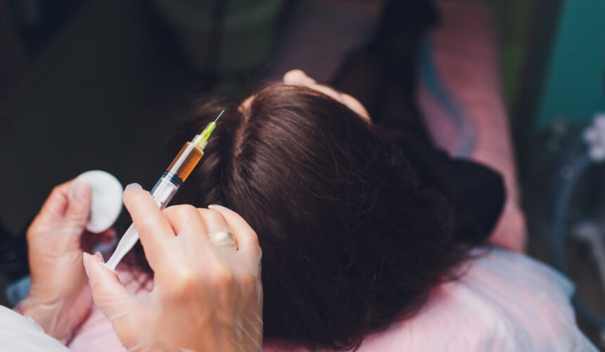 Fibryna i osocze bogatopłytkowe w dermatologii estetycznej Fibryna i osocze bogatopłytkowe w dermatologii estetycznej