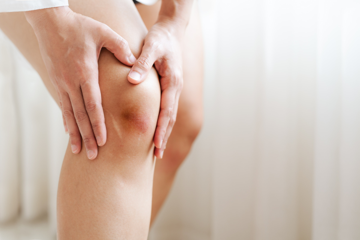 Zranione kolano kobiety. Ból kolana - przyczyny