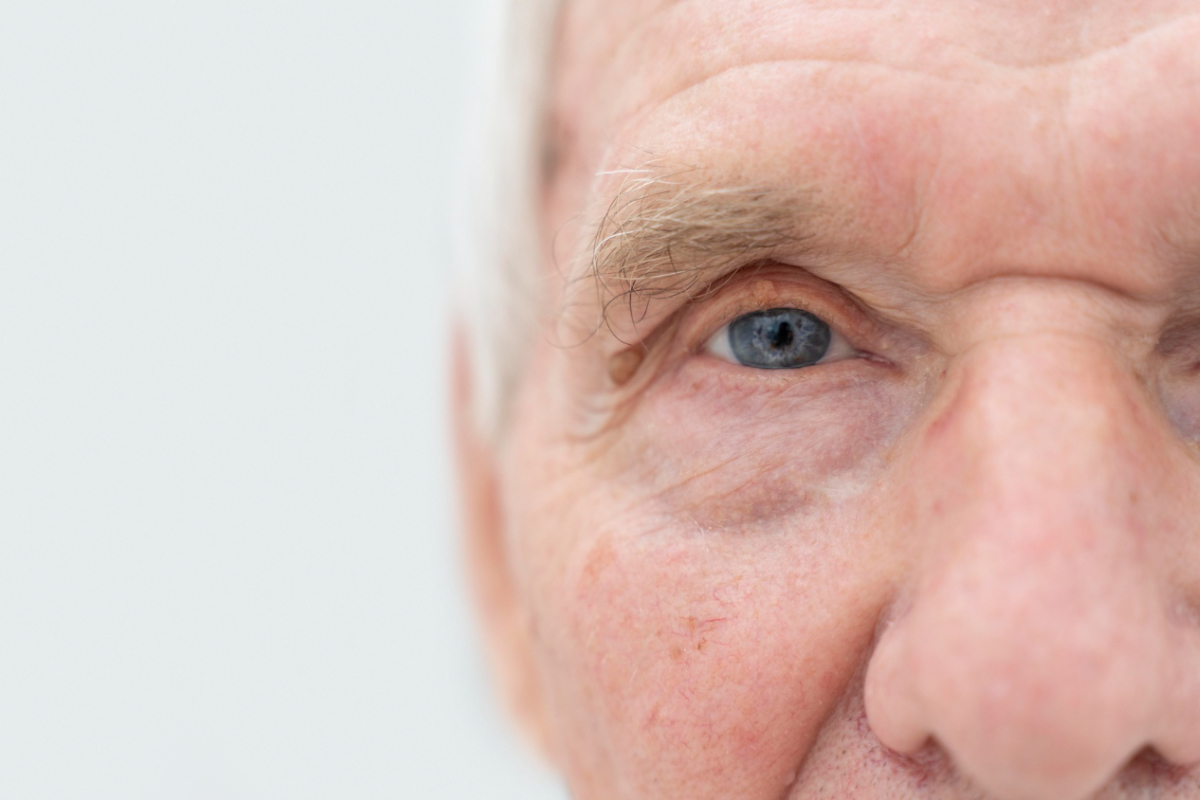 Twarz starszego mężczyzny. Zapalenie gruczołu łzowego — jak się objawia