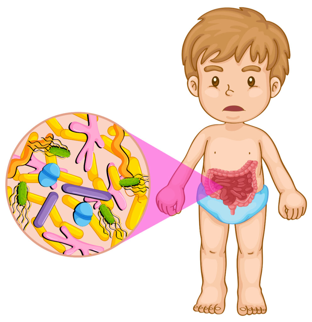 Chłopiec z bakteryjnym zapaleniem jelit