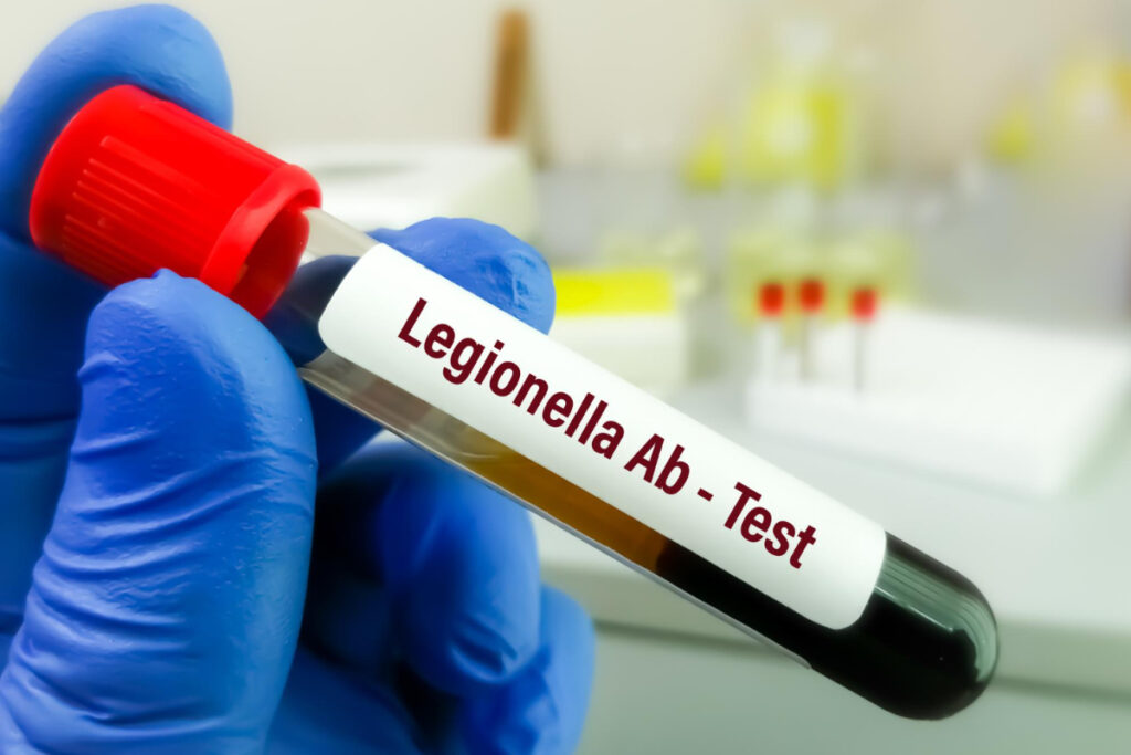 Test na przeciwciała bakterii Legionella pneumophila