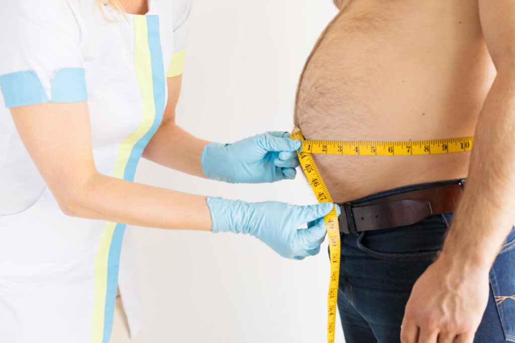 Dietetyczka mierzy obwód w pasie otyłego mężczyzny. Rodzaje otyłości.