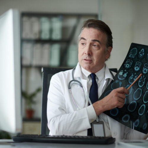 Neurochirurg wskazuje na wyniki skanu mózgu. kim jest neurochirurg i jakie choroby leczy