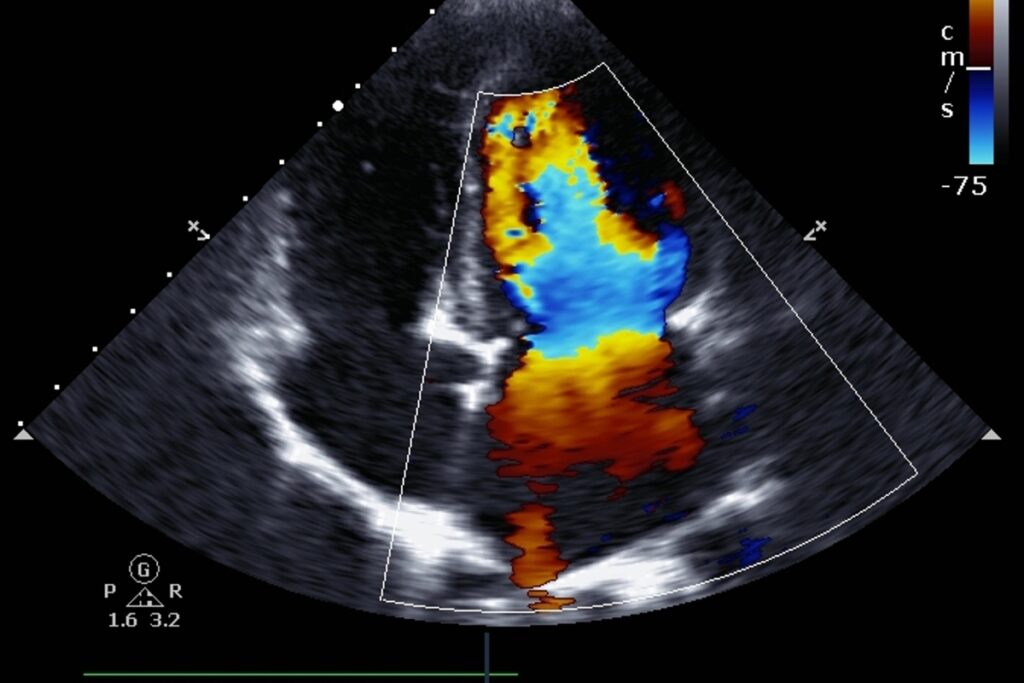 USG Doppler. Diagnostyka USG