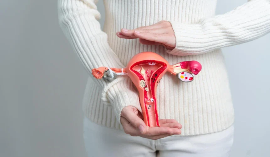 leczenie-pcos Leczenie PCOS